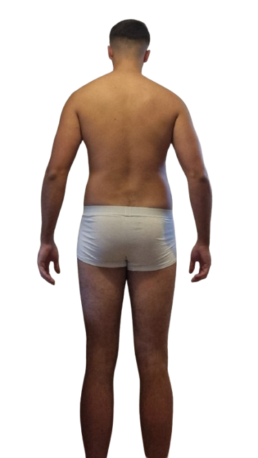 Anthony, Rückenansicht vor dem Coaching